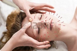 Frau-Akupunktur /123rf